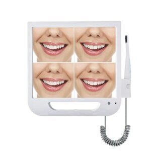 Digital Intraoral Camera