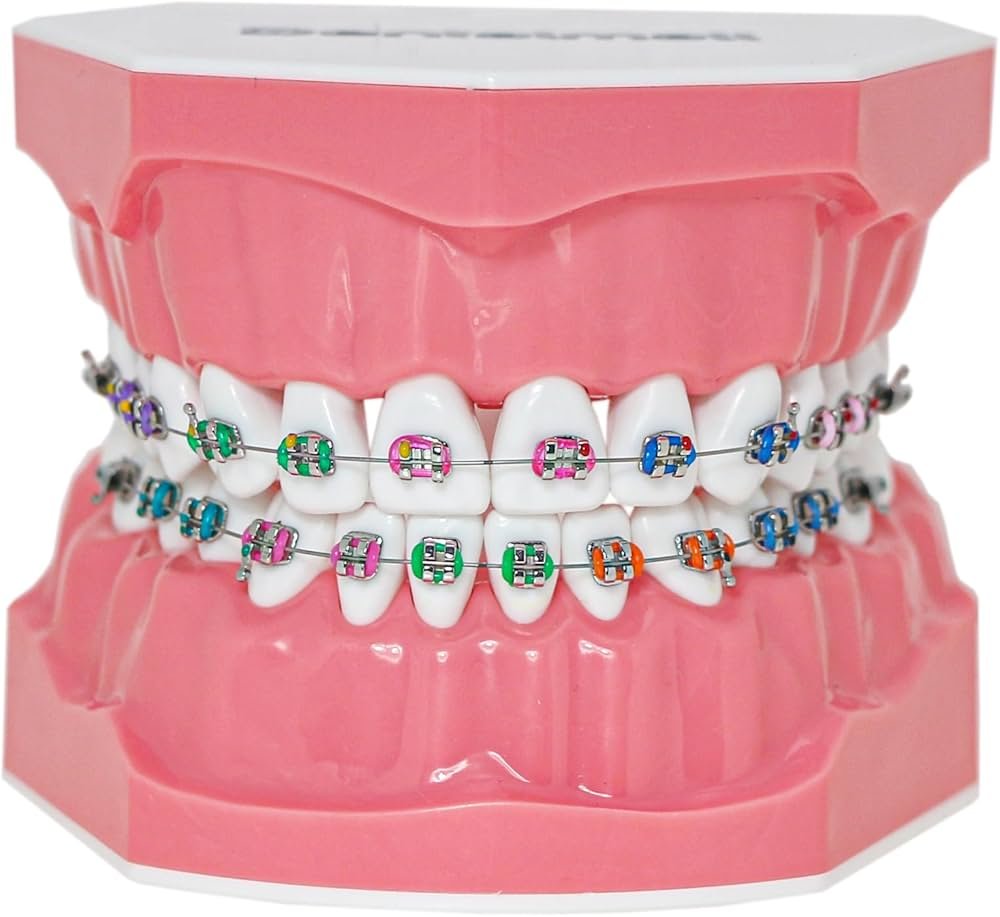 Orthodontic brackets and supplies in Tanzania